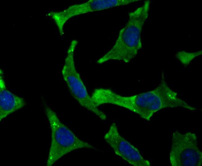 Anti-SDCBP Antibody (1Q650)