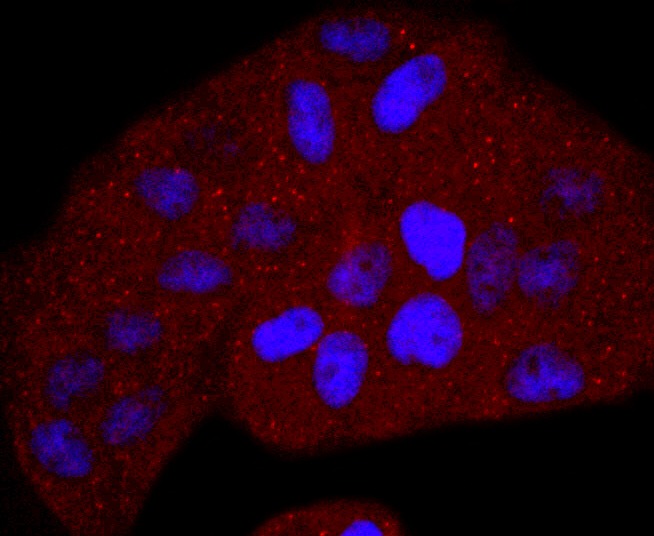 Anti-TK1 Antibody (6W861)