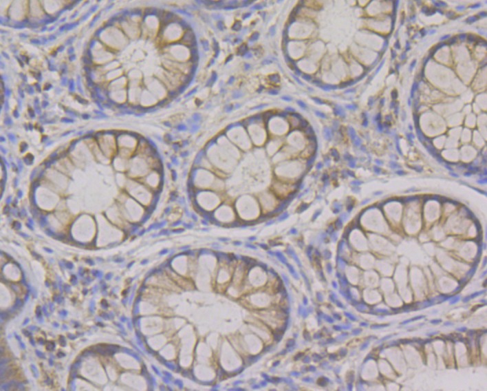 Anti-Syntrophin alpha 1 Antibody (6T145)