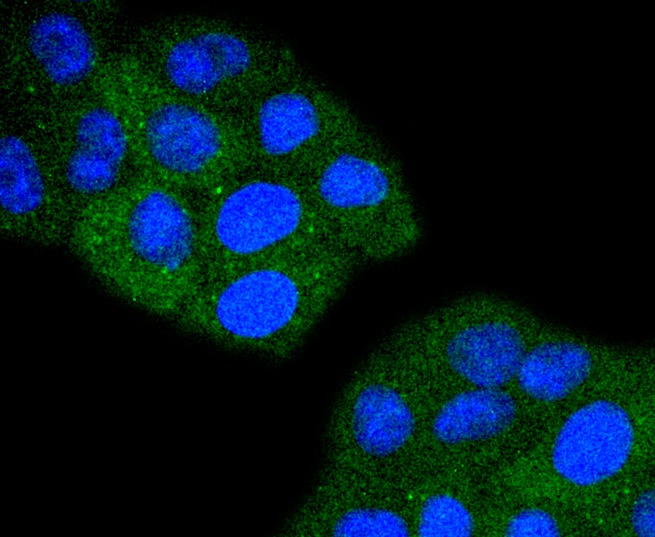 Anti-TACC3 Antibody (7N742)