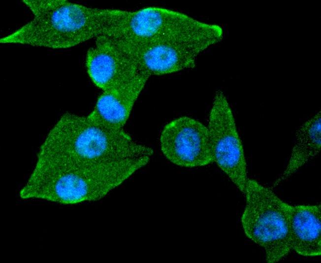 Anti-TACC3 Antibody (3B27)