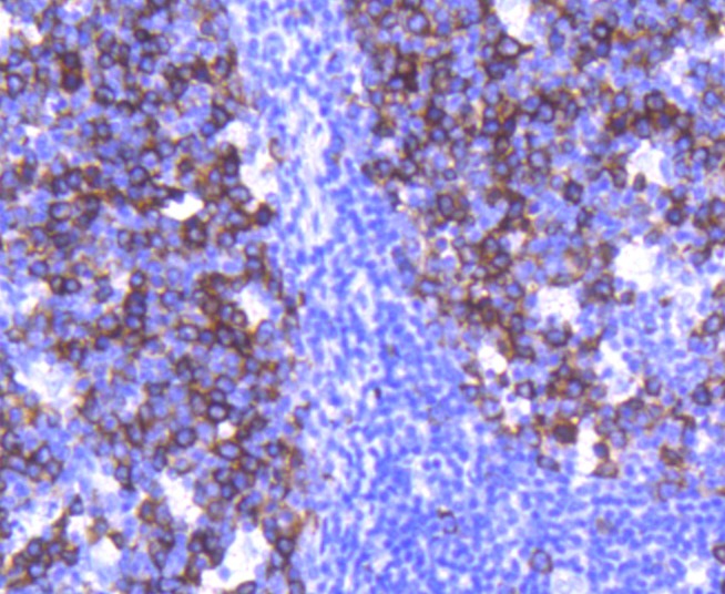 Anti-TACC3 Antibody (7N742)