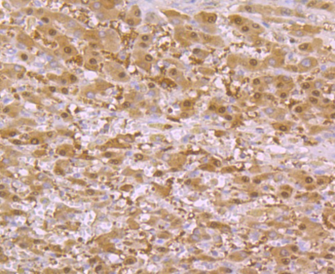 Anti-SULT2A1 Antibody (1I505)