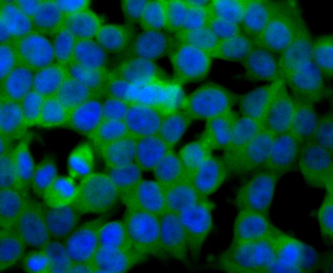Anti-SULT2A1 Antibody (1I505)