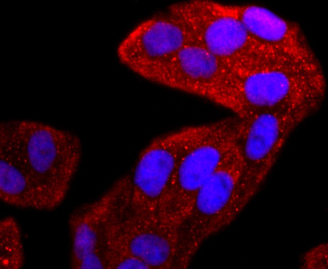 Anti-TIA1 Antibody (9Q940)