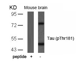 Anti-Phospho-MAPT (Thr181) Polyclonal Antibody