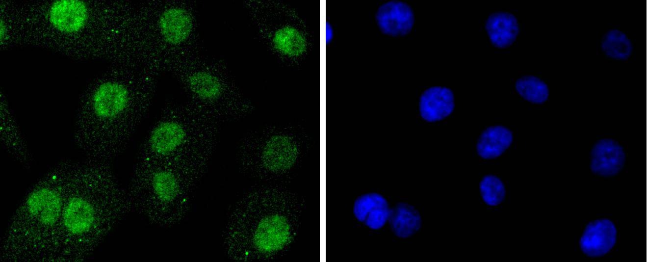 Anti-SUMO3 Antibody (9E189)