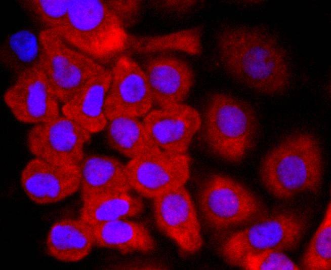 Anti-Thioredoxin/TRX Antibody (5F422)