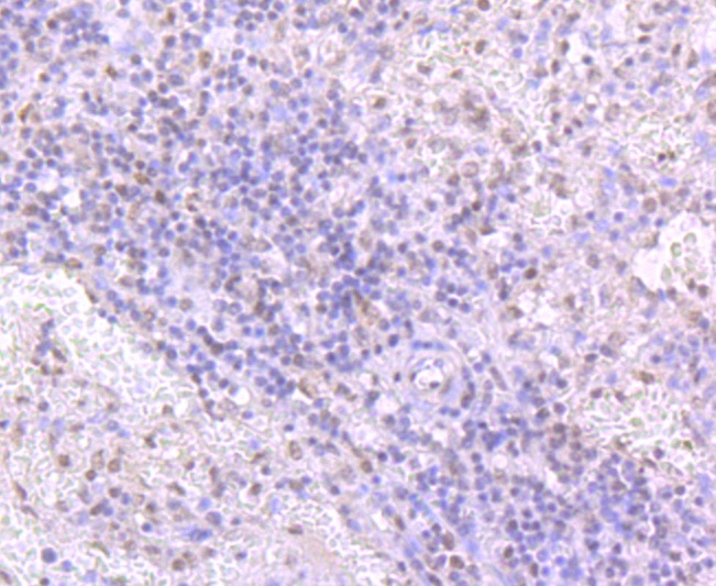 Anti-TARDBP Antibody (8Y416)