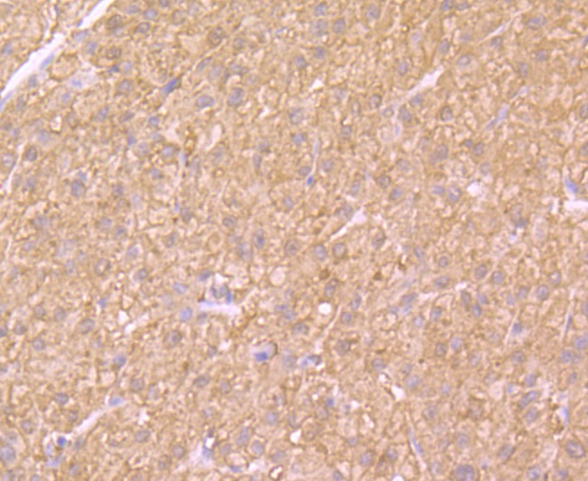 Anti-SULT2A1 Antibody (1I505)
