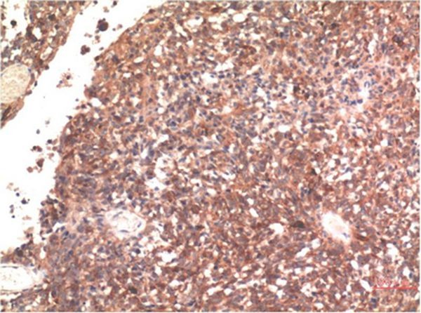 Anti-MAPT Antibody (2Y191)