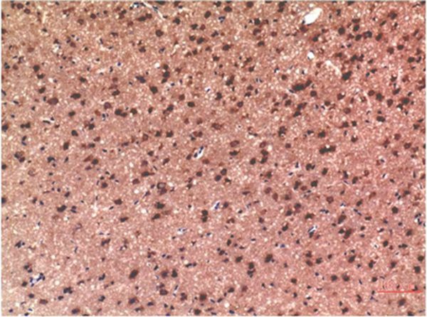 Anti-MAPT Antibody (2Y191)