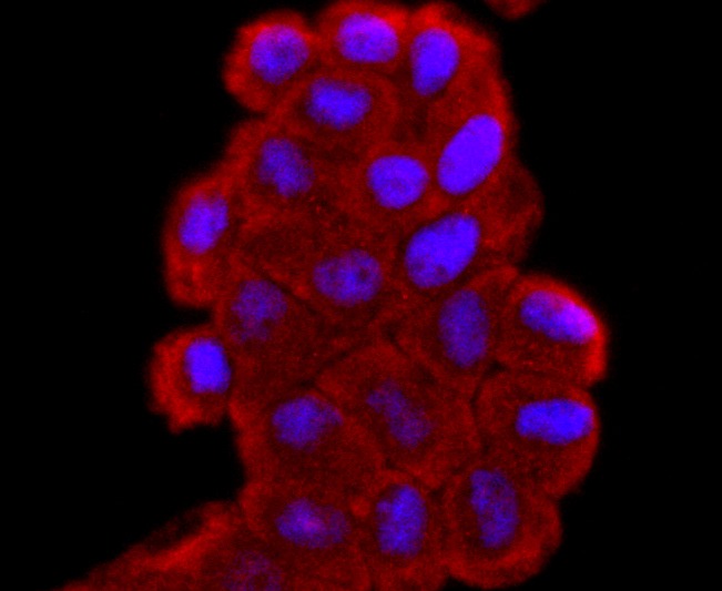Anti-SOD1 Antibody (4Y683)