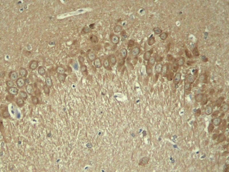 Anti-Phospho-MAPT (Thr181) Polyclonal Antibody
