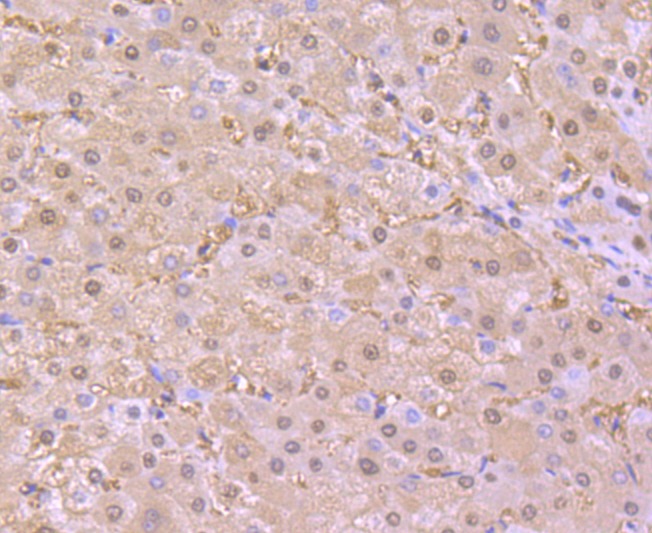 Anti-SOD1 Antibody (4Y683)