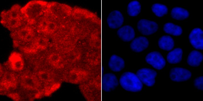 Anti-TARDBP Antibody (8Y416)