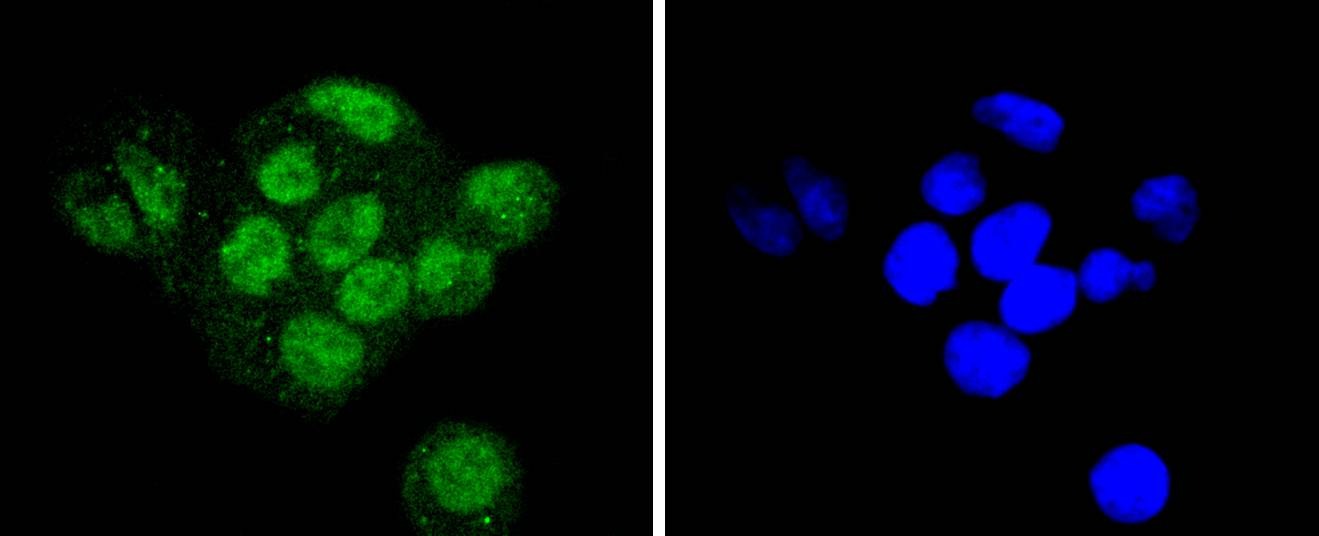 Anti-SUMO3 Antibody (9E189)