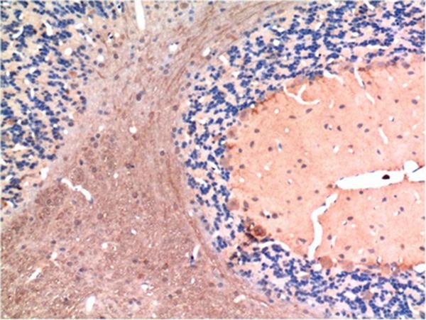 Anti-TGF beta 1 Antibody (5T525)