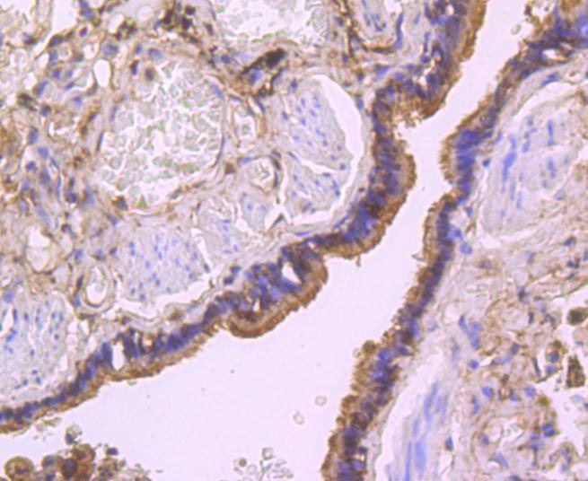 Anti-Thioredoxin/TRX Antibody (5F422)