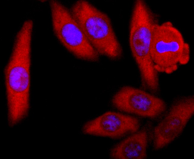 Anti-SOD1 Antibody (4Y683)