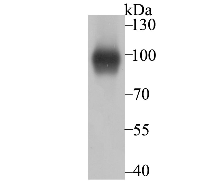 Anti-Thrombomodulin Antibody (5U850)
