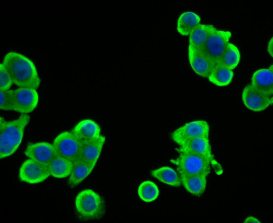 Anti-SULT2A1 Antibody (1I505)