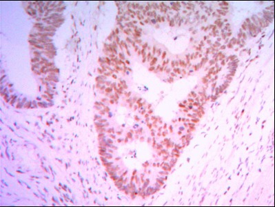 Anti-THAP11 Antibody (8P657)