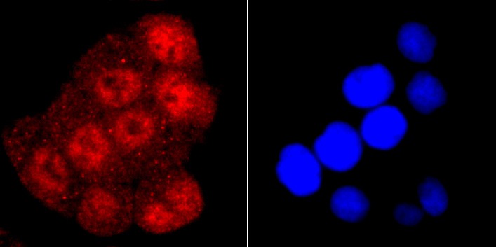 Anti-TARDBP Antibody (8Y416)