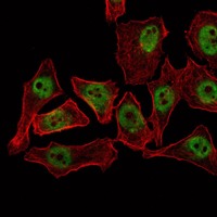 Anti-THAP11 Antibody (8P657)