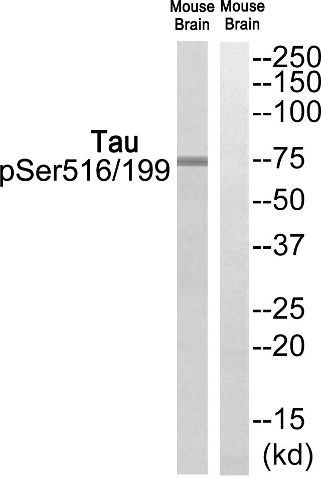 Anti-Phospho-MAPT (Ser516, 199) Polyclonal Antibody