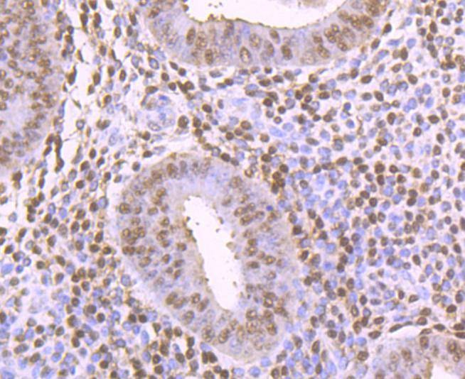 Anti-Thioredoxin/TRX Antibody (5F422)