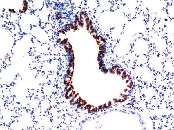 Anti-TGF beta 1 Antibody (5T525)