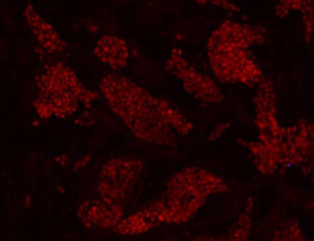 Anti-UTF1 Antibody (4R603)