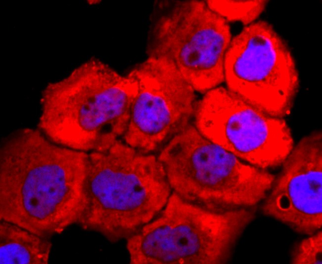 Anti-Tyrosinase/TYR Antibody (5B146)