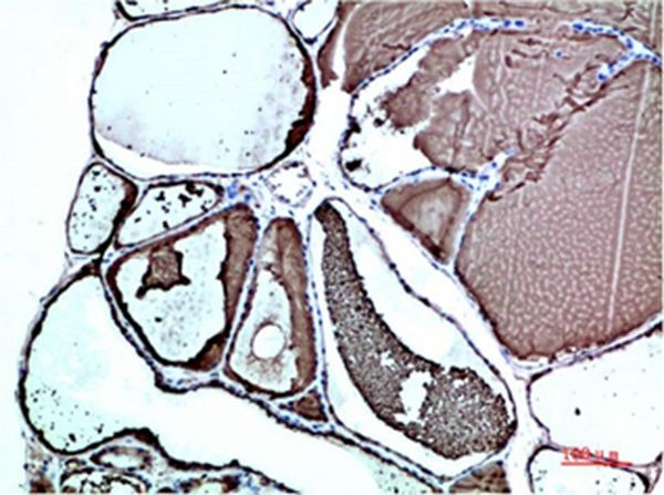 Anti-Transthyretin Antibody (3O334)