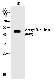 Anti-Acetyl-Tubulin α (Lys40) Polyclonal Antibody