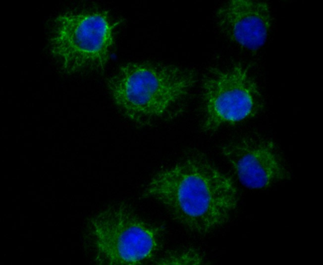 Anti-TRP1 Antibody (9T409)