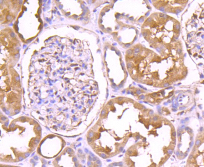 Anti-TRXR1/TXNRD1 Antibody (8M522)