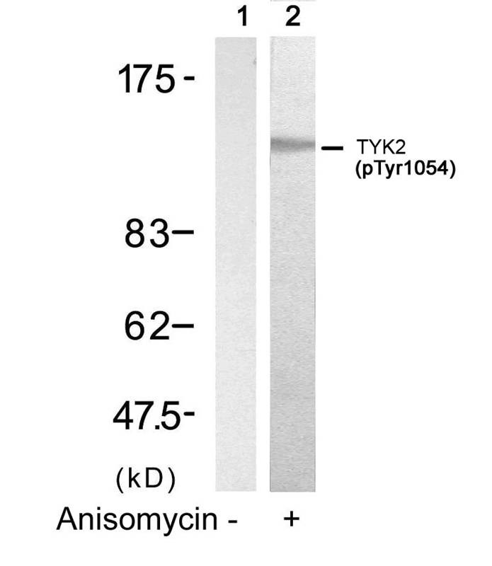 Anti-Phospho-TYK2 (Tyr1054) Polyclonal Antibody