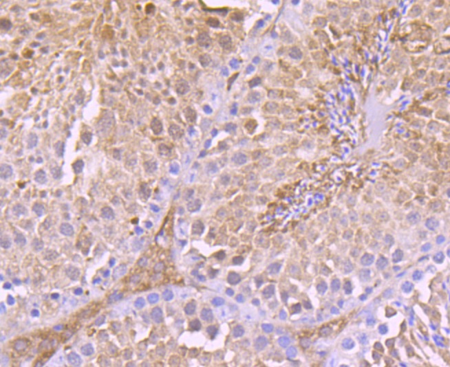 Anti-TRXR1/TXNRD1 Antibody (8M522)