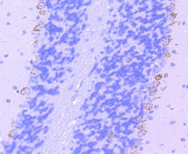 Anti-Tryptophan Hydroxylase 1/TPH-1 Antibody (9H209)