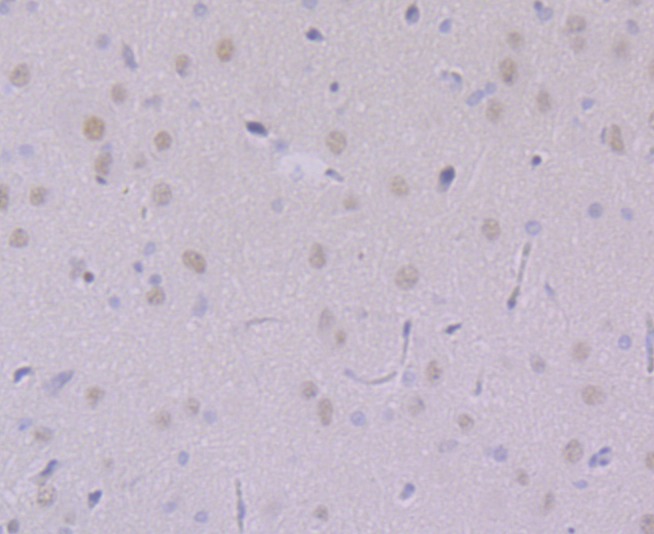 Anti-USP7 Antibody (8N914)