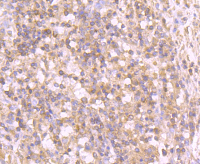 Anti-Tyrosinase/TYR Antibody (5B146)