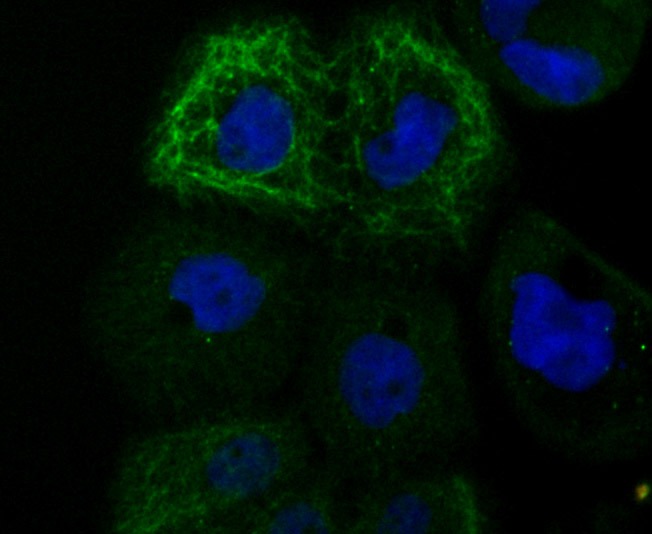 Anti-TRP1 Antibody (9T409)