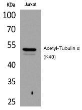 Anti-Acetyl-Tubulin α (Lys40) Polyclonal Antibody