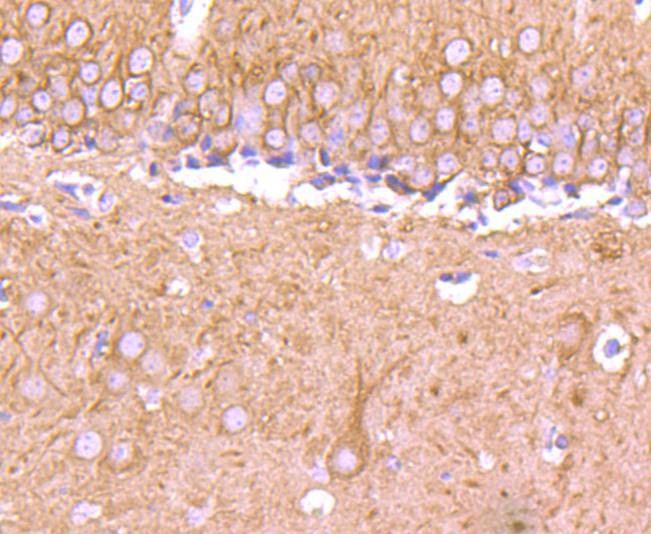 Anti-TUBB3 Antibody (5D159)