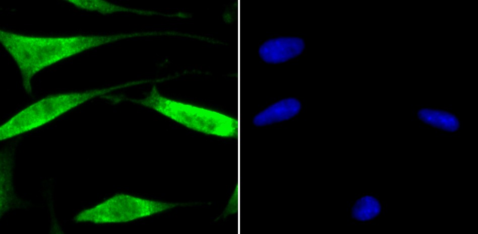 Anti-USP13 Antibody (7A655)