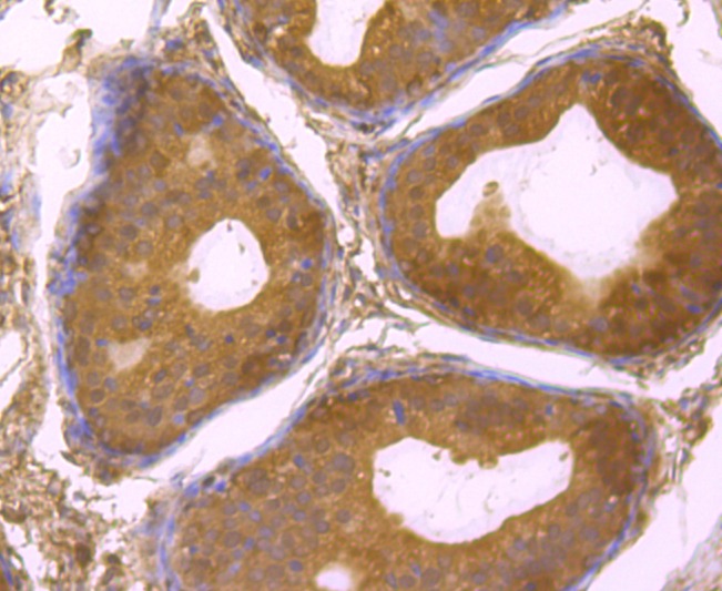 Anti-USP14 Antibody (2A615)