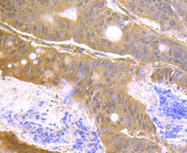 Anti-USP14 Antibody (2A615)