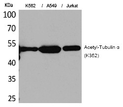 Anti-Acetyl-Tubulin α (Lys352) Polyclonal Antibody